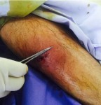 alejandro-fernndez-tuvo-gangrena-pero-no-fue-mordido-por-jaguar