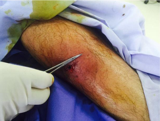 alejandro-fernndez-tuvo-gangrena-pero-no-fue-mordido-por-jaguar alejandro-fernndez-tuvo-gangrena-pero-no-fue-mordido-por-jaguar