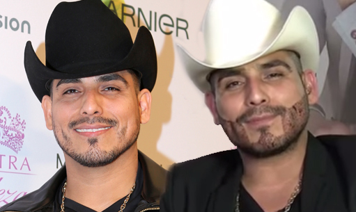 espinoza-paz-se-puso-injertos-en-su-barba